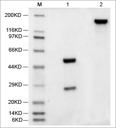 Electrophoresis of humanized IgG purified from cell culture supernatant by Monofinity A Resin Electrophoresis of humanized IgG purified from cell culture supernatant by Monofinity A Resin