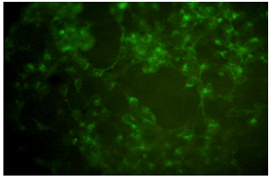 Membrane Protein