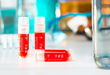 Hybridoma & Phage Display