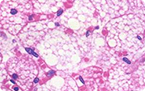 White adipose converts to brown adipose with adrenergic stress
