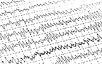 REM sleep, beta-amyloid