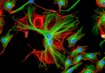 A newly discovered fluorescent reporter protein could help cells shine brighter