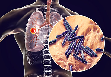 Driving Mycobacterium tuberculosis to its death by keeping the accelerator on cell replication