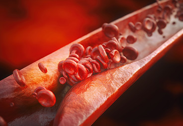 The cause of heart disease is linked to a specific type of foreign lipid