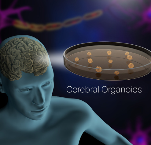 Cerebral organoids