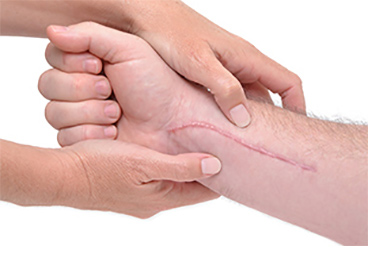 The skin remembers injuries from sticks and stones, can heal recurring wounds faster