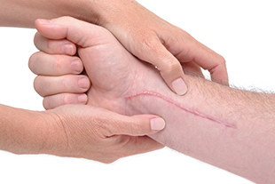 dermatology, scars, wound healing, stem cells, skin regeneration, skin cells