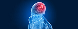 Treating glioma through targeting tumor microenvironment