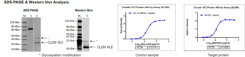SDS-PAGE & Western blot analysis SDS-PAGE & Western blot analysis