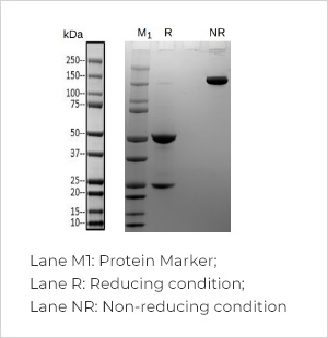 TurboCHO™ antibody expression-SDS-PAGE