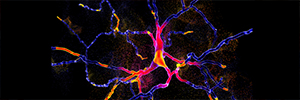 Llama-derived Nanobodies in the Fight Against Parkinson’s Disease